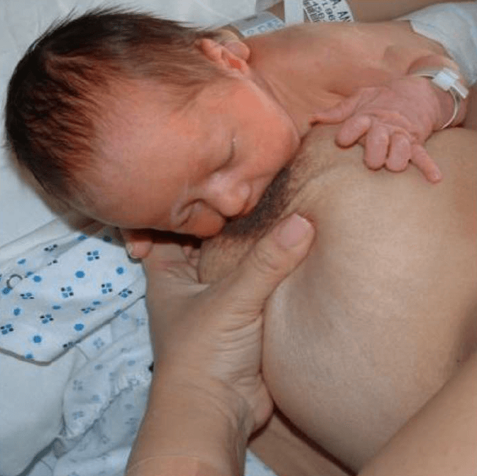 Sore Nipples - MD Pediatric Associates